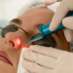 The Essential Benefits of Professional Laser Treatment Consultation