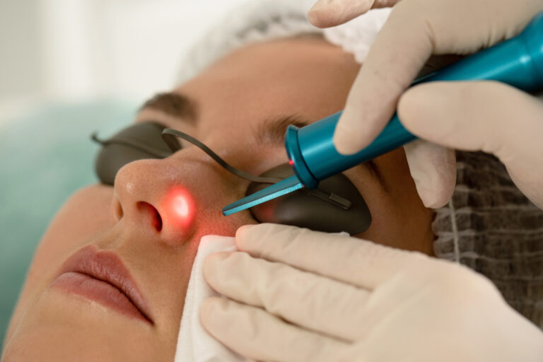 The Essential Benefits of Professional Laser Treatment Consultation