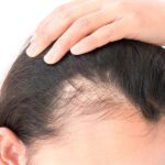 Debunking Myths, Embracing Routine: The Role of a Shampoo to Stop Hair Loss in Hair Maintenance