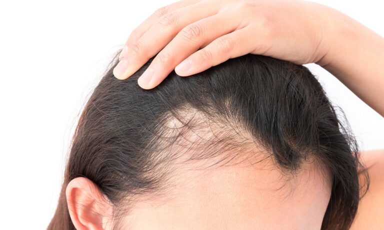 Debunking Myths, Embracing Routine: The Role of a Shampoo to Stop Hair Loss in Hair Maintenance