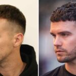 A Fuller Look: The Growing Demand for Beard and Eyebrow Hair Transplant UK Services