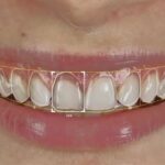 Planning, Design, and Approval: The Real Experience of a Dental CAD Design Service