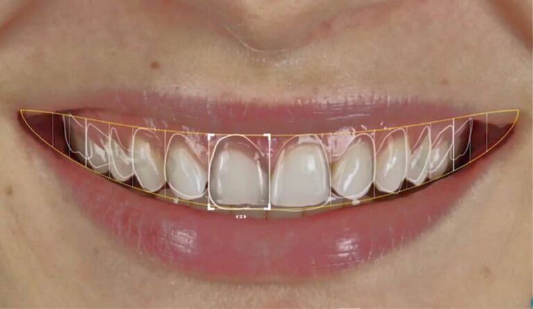 Planning, Design, and Approval: The Real Experience of a Dental CAD Design Service
